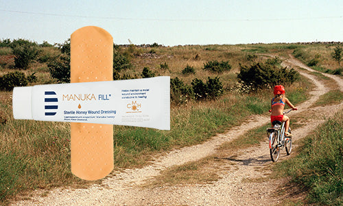 Skrubbsår och skrapsår - Så här behandlar du